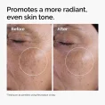 ord-glycolic-before-after-radiance