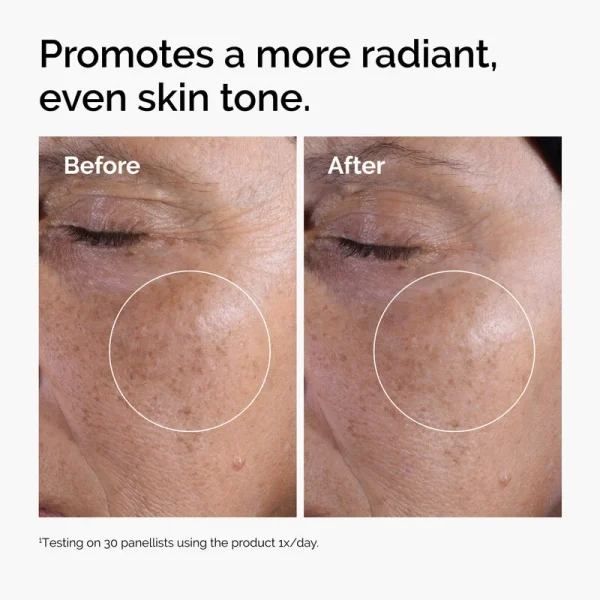 ord-glycolic-before-after-radiance